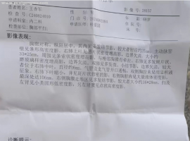 6次化疗后继续治疗方案怎么选？