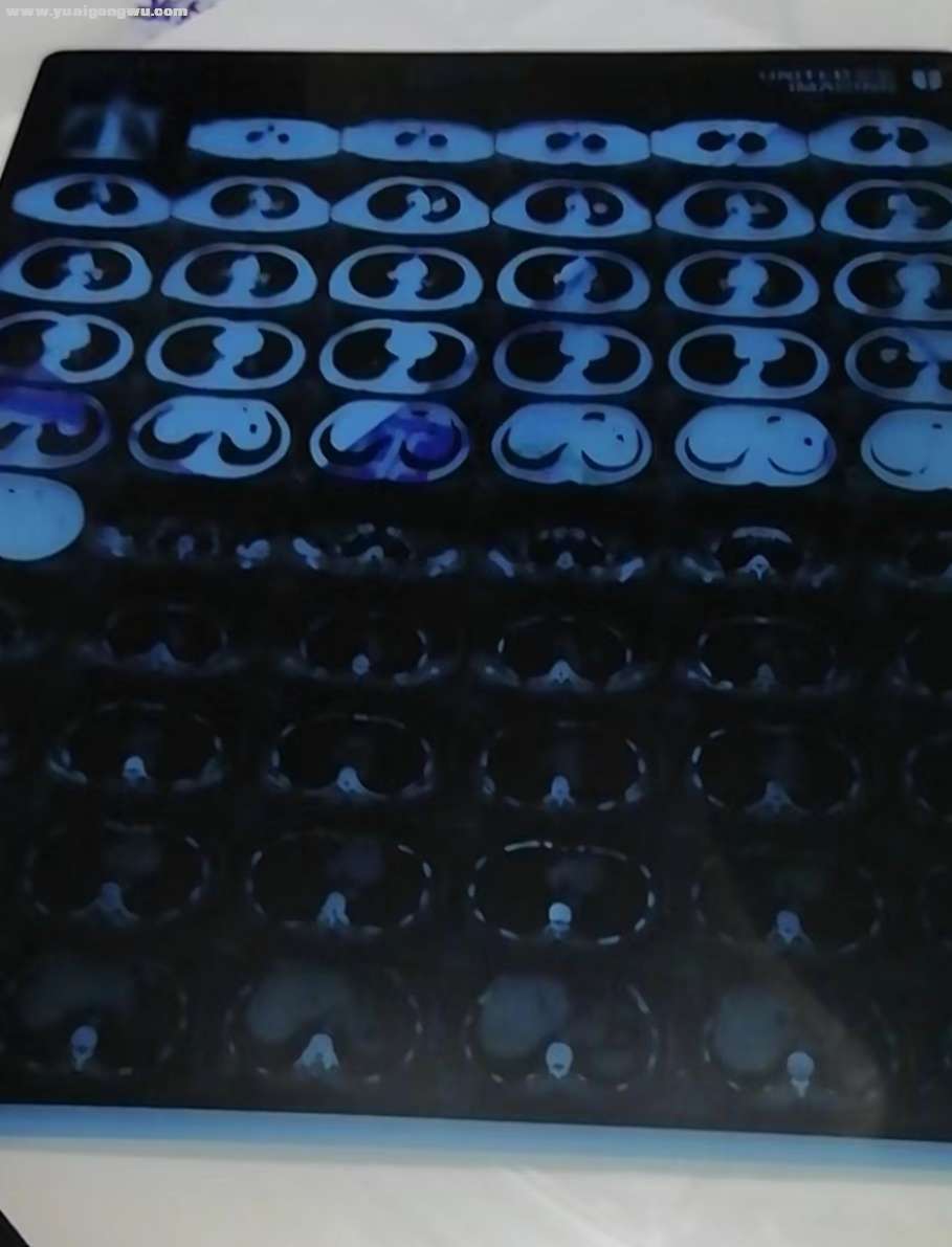 1665126160187268_343.jpg